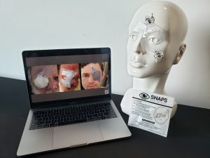 Intermed's SNAPS re-envisions eye shields to help eye surgery patients recover more easily